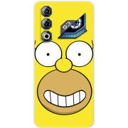 Чохол BoxFace Nubia Neo 3 GT 5G 