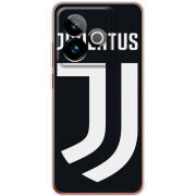 Чохол BoxFace Realme GT 7 5G FC J