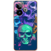 Чохол BoxFace Realme GT 7 5G 