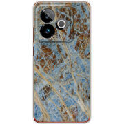 Чохол BoxFace Realme GT 7T 5G 