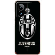 Чохол BoxFace Realme GT 7T 5G 