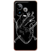 Чохол BoxFace Realme GT 7T 5G 