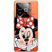 Прозорий чохол BoxFace Realme GT 7T 5G Lady M