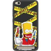 Черный чехол Uprint Xiaomi Redmi 5A White Bart