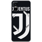 Чохол BoxFace Infinix GT 30 Pro FC J