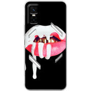 Чохол BoxFace Infinix GT 30 Pro 