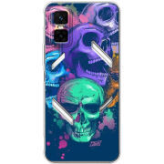 Чохол BoxFace Infinix GT 30 Pro 