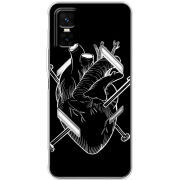 Чохол BoxFace Infinix GT 30 Pro 