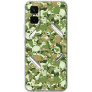 Чохол BoxFace Infinix GT 30 Pro 