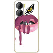 Чохол BoxFace Nubia Neo 3 5G 