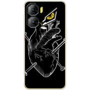 Чохол BoxFace Nubia Neo 3 5G 