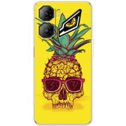 Чохол BoxFace Nubia Neo 3 5G Pineapple Skull