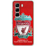 Чохол BoxFace Infinix Hot 60 Pro 