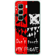 Чохол BoxFace Infinix Hot 60 Pro Bad Smile