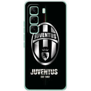 Чохол BoxFace Infinix Hot 60 Pro 