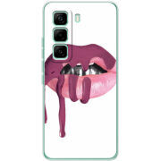 Чохол BoxFace Infinix Hot 60 Pro 