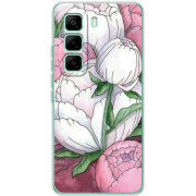 Чохол BoxFace Infinix Hot 60 Pro 