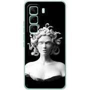 Чохол BoxFace Infinix Hot 60 Pro 