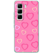 Чохол BoxFace Infinix Hot 60 Pro Sugar Hearts