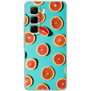 Чохол BoxFace Infinix Hot 60 Pro 