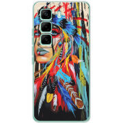 Чохол BoxFace Infinix Hot 60 Pro 