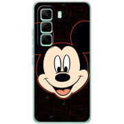 Чохол BoxFace Infinix Hot 60 Pro 