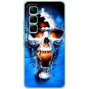 Чохол BoxFace Infinix Hot 60 Pro 