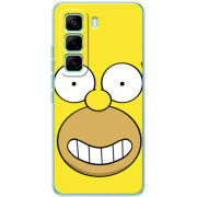 Чохол BoxFace Infinix Hot 60 Pro 