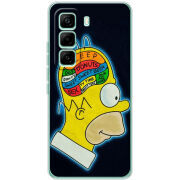 Чохол BoxFace Infinix Hot 60 Pro 