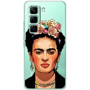 Прозорий чохол BoxFace Infinix Hot 60 Pro Фрида Кало