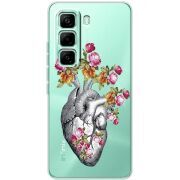 Чохол зі стразами Infinix Hot 60 Pro Heart