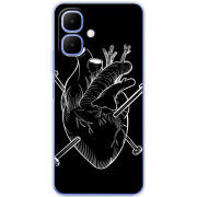 Чохол BoxFace Tecno Go 2 