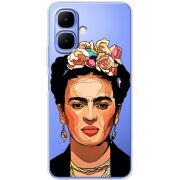 Прозорий чохол BoxFace Tecno Spark Go 2 Фрида Кало