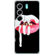 Чохол BoxFace Tecno Camon 40 