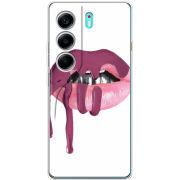 Чохол BoxFace Tecno Camon 40 