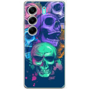 Чохол BoxFace Tecno Camon 40 