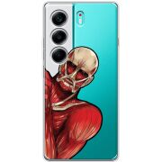 Прозорий чохол BoxFace Tecno Camon 40 Титан