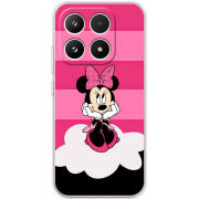 Чохол BoxFace Xiaomi 17 