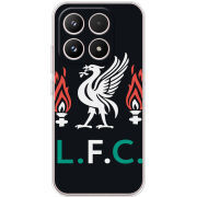 Чохол BoxFace Xiaomi 17 L. F. C.