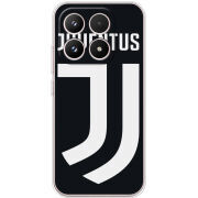 Чохол BoxFace Xiaomi 17 FC J