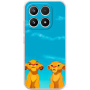 Чохол BoxFace Xiaomi 17 