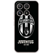 Чохол BoxFace Xiaomi 17 