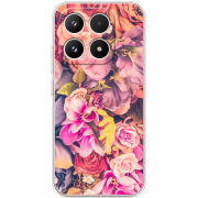 Чохол BoxFace Xiaomi 17 