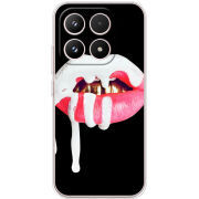 Чохол BoxFace Xiaomi 17 