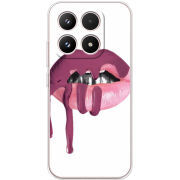 Чохол BoxFace Xiaomi 17 