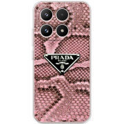 Чохол BoxFace Xiaomi 17 