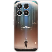 Чохол BoxFace Xiaomi 17 