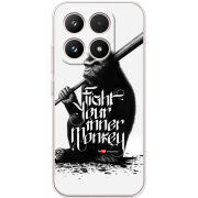 Чохол BoxFace Xiaomi 17 