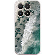 Чохол BoxFace Xiaomi 17 