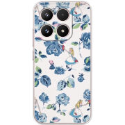 Чохол BoxFace Xiaomi 17 